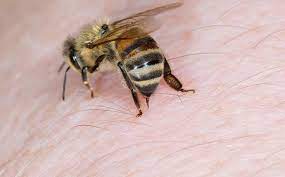 Are bee stings poisonous?